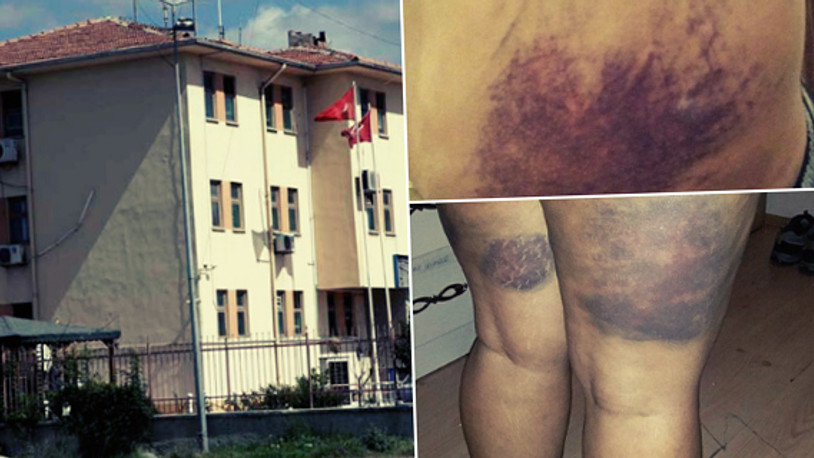 Karakolda işkence: Bugün sporumu üzerinizde yaptım!