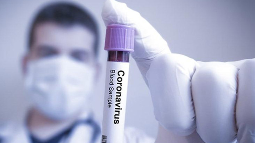 Korona virüs vakası bir ülkeye daha sıçradı