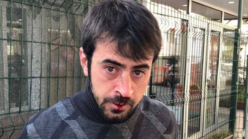 İşçilerin ücretini 4 aydır ödemeyen patronlar sendika görevlisinin burnunu kırdı