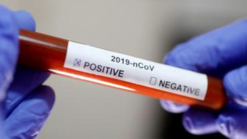 1 aylık bebeğe koronavirüs teşhisi