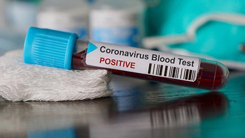 65 bin emekli sağlık çalışanı koronavirüs salgını nedeniyle göreve çağırılıyor