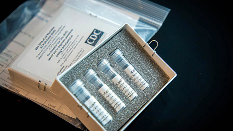 İrlandalı firma hızlı sonuç veren koronavirüs testi üretti