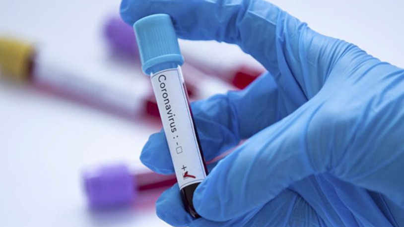 Özbekistan'da ilk kez koronavirüs vakası ortaya çıktı