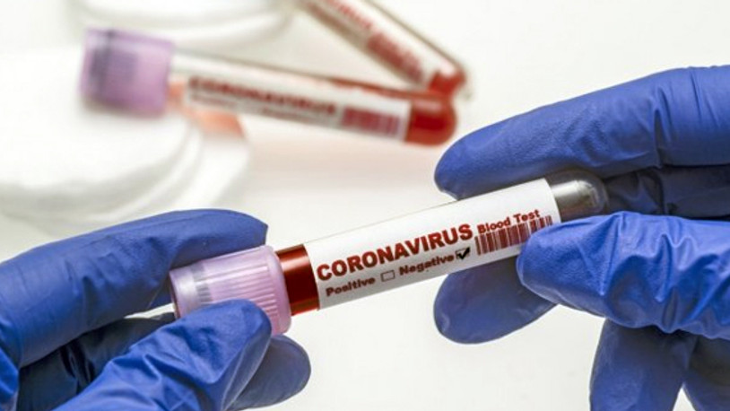 Rapor süresi 14 güne yükseltildi