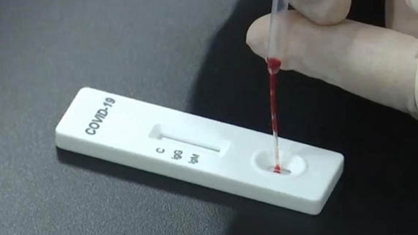 Sağlık Bakanlığı: 15 dakikada sonuç verebilen hızlı tanı kiti uygulamasına başladık