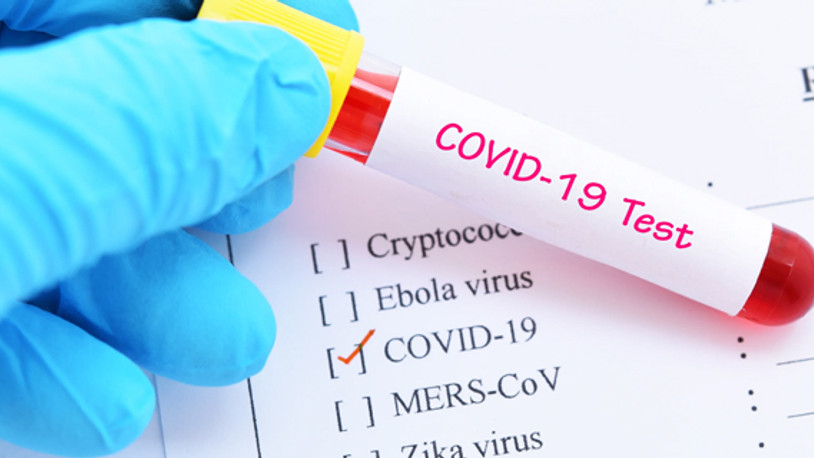 Doktorların koronavirüs reçetesi yazmasına kısıtlama...