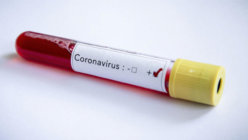 İyileşen koronavirüs vakaları nasıl yeniden pozitif vaka oluyor?