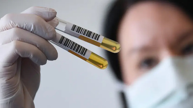 Kritik uyarı: Sosyal medyada plazma aramayın