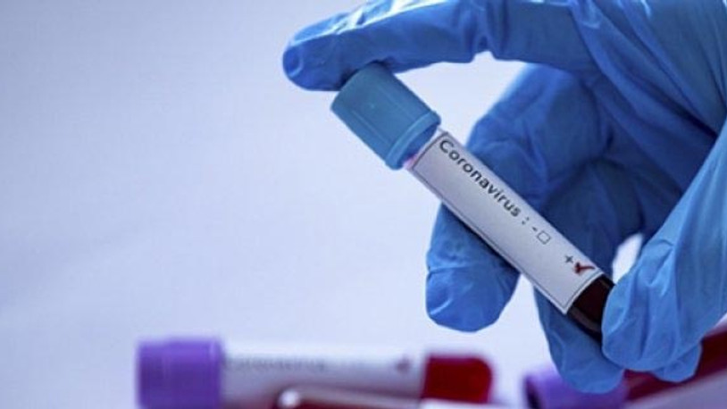 'Koronavirüslüyüm' diyerek polise tüküren kişi hapis cezası aldı