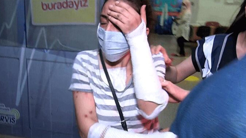 Erkek arkadaşının yüzüne kezzap atan kadının koronavirüs testi pozitif çıktı