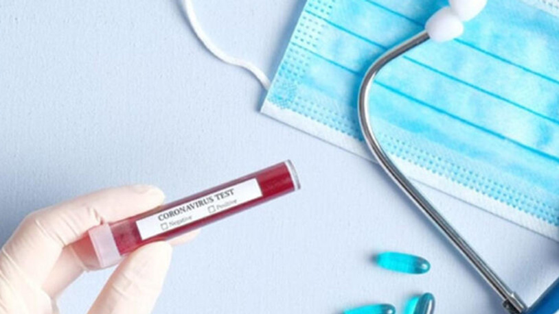 Milliyet, ATV ve DHA’da 6 çalışan koronavirüse yakalandı