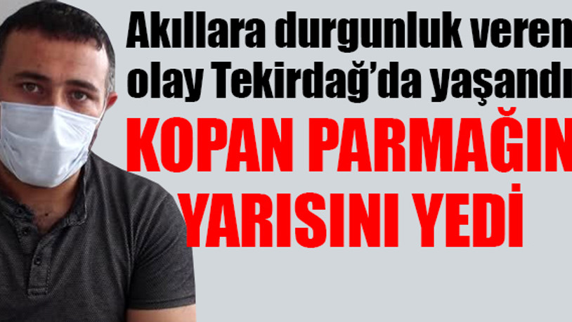 İşçinin yemeğinden kopmuş parmak çıktı