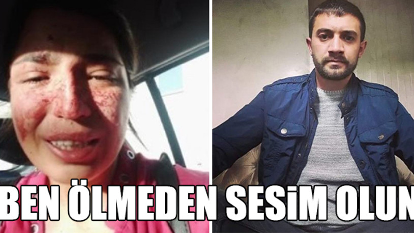 Eski eşinden şiddet gören Sibel, yardım istedi: Arkamda gözü yaşlı bir evlat bırakmak istemiyorum