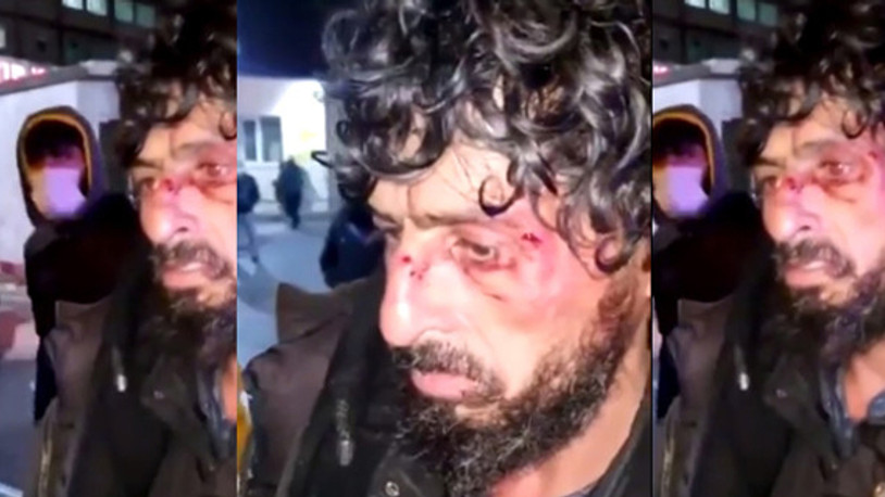 İstanbul’da bir hastanenin güvenlik amiri, evsiz yurttaşı öldüresiye dövdü