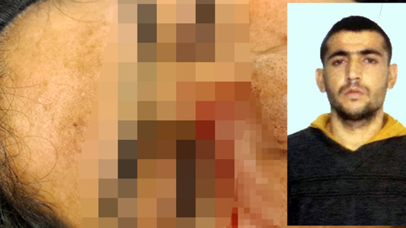 Kahvaltı hazırlamadığı gerekçesiyle birlikte yaşadığı kadını darp edip bıçakladı