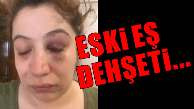 "Can çekişerek mi yoksa kurşunla mı öldürüleceğim onu düşünüyorum"