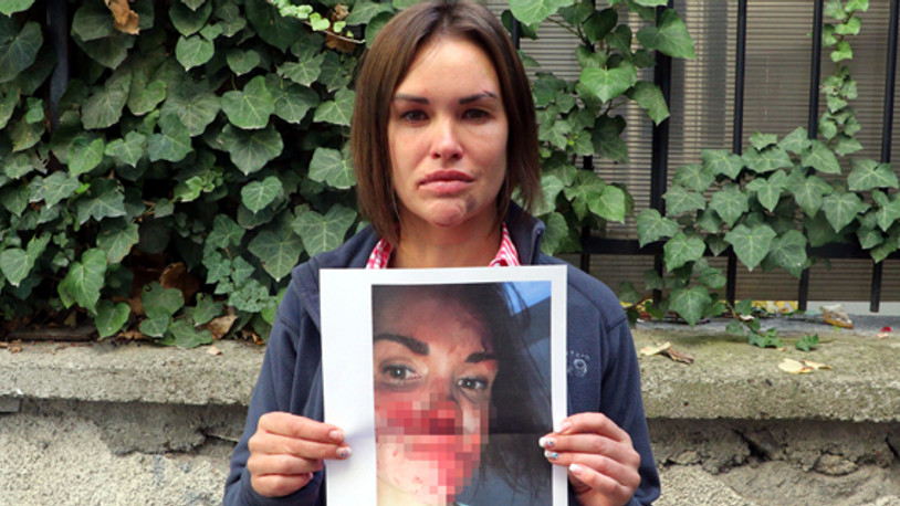 Şiddet gördüğü için gündeme gelen güzellik uzmanı evinde ölü bulunmuştu: Yeni gelişme