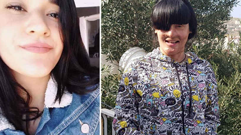 Casim Ozan Çeltik tarafından yüzüne asit atılan Berfin konuştu 