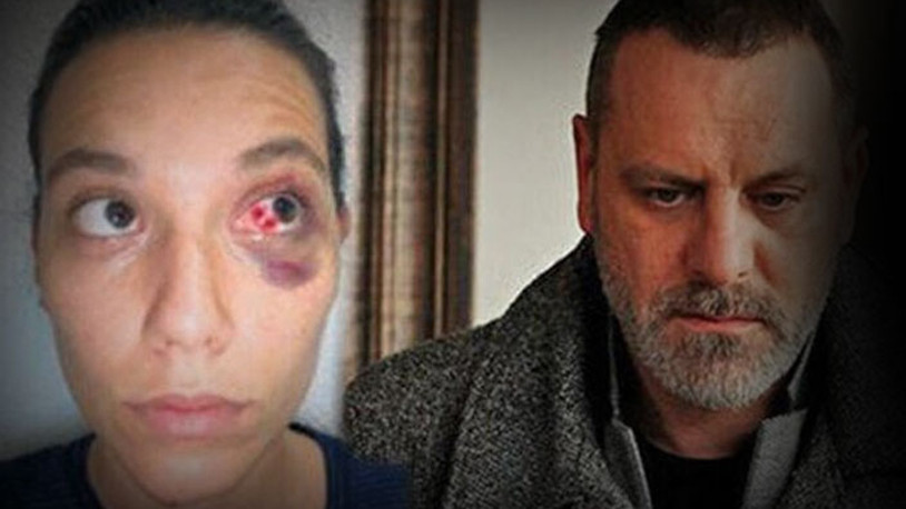 Deniz Bulutsuz ve Ozan Güven davası ertelendi