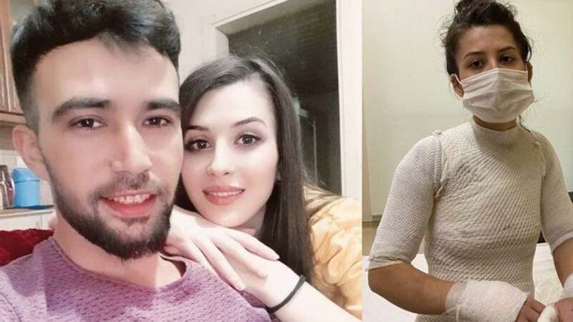 Eşi tarafından sıcak su ile 'haşlanan' kadının söyledikleri yürek yaktı