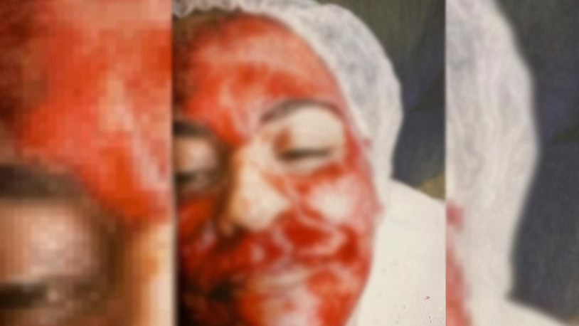 Güzellik merkezinde korkunç olay: Kadının yüzü kanlar içinde kaldı