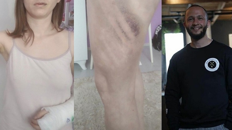 Kız arkadaşını beyzbol sopasıyla darp eden erkek tutuklandı