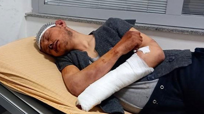 Patronun saatlerce dövdüğü çırağa da hapis cezası istendi