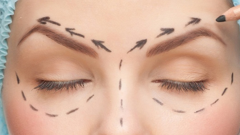 Diyanet'ten estetik fetvası