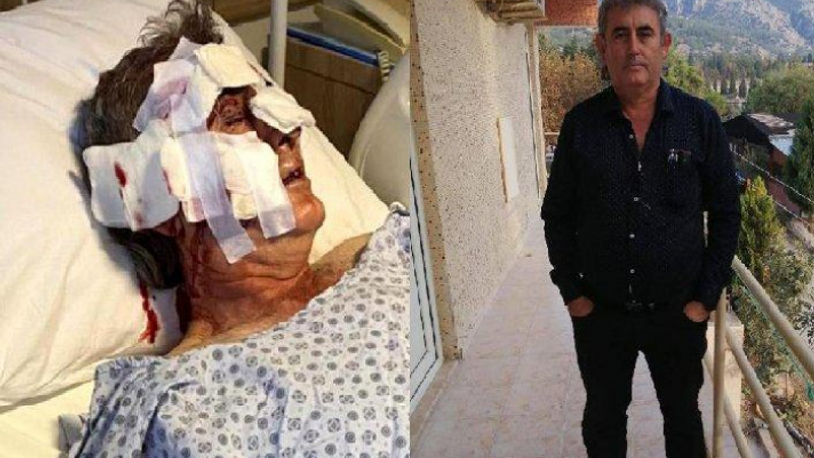 Kafesten kaçan maymun otel çalışanına saldırdı