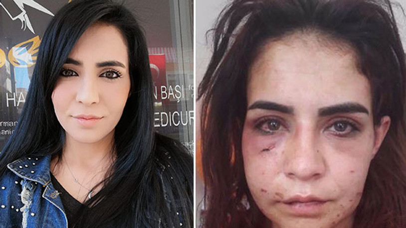 Kendisini bayıltana kadar darp eden erkek savcılık talimatıyla serbest bırakıldı