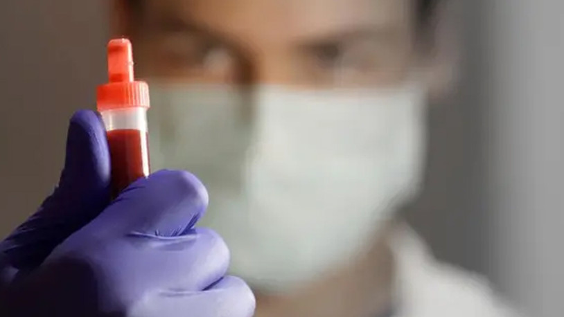 Koronavirüsü atlatanlar dikkat: Doktorlarda 9 ay, ev kadınlarında ise 3 ay koruyor