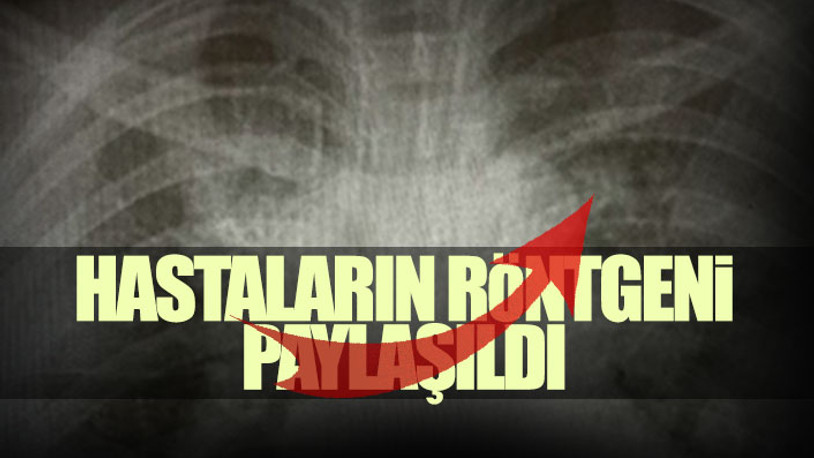 Mutant virüs alarmı: Yoğun bakımlar gençlerle dolu