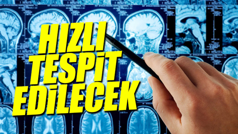 Beyin tümörü teşhisinde çığır açan keşif