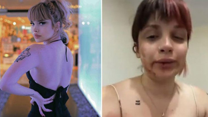 Fenomen Başak Ermiş, tayt giydiği için öldüresiye darp edildi