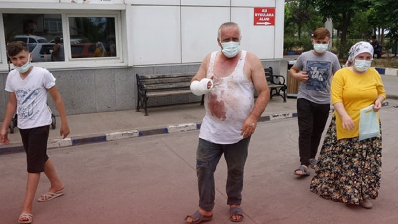 AKP'li belediye başkanı kurban keserken yaralandı