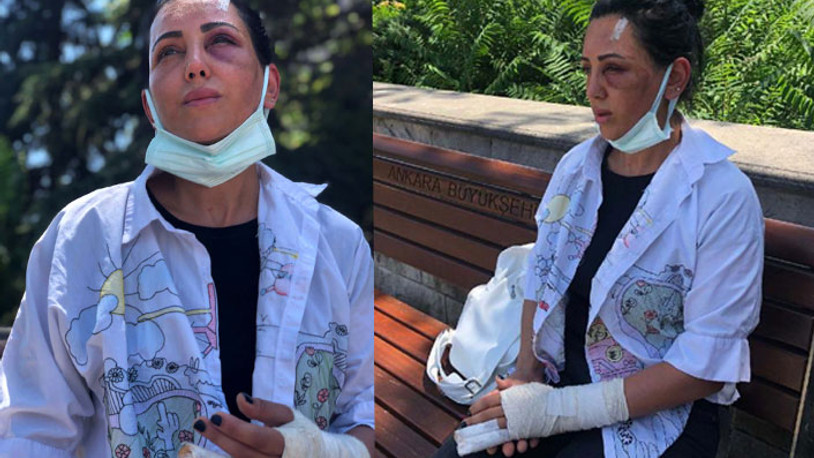 Eski sevgilisi takside dehşeti yaşattı: 20 dakika boyunca darp etti