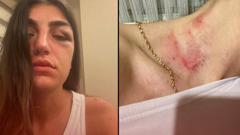 Genç mankene gece kulübünde feci dayak