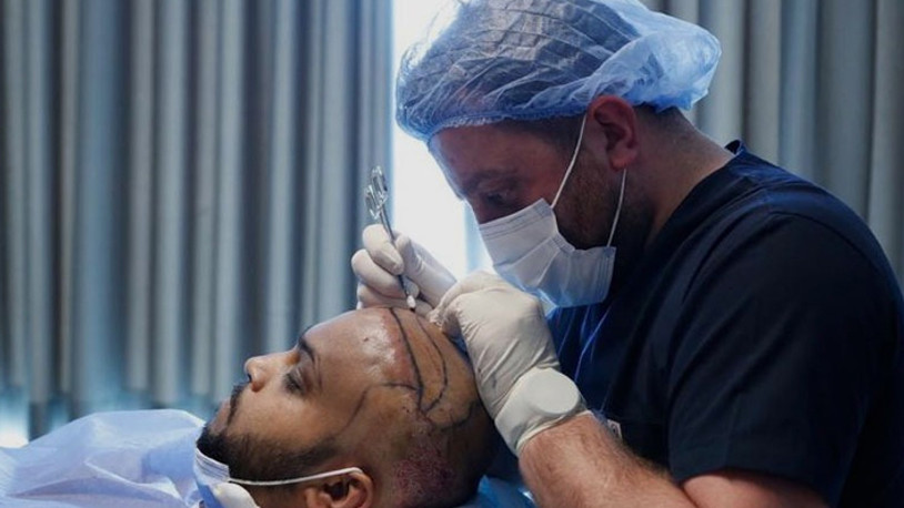 2021 Yılında Saç Ekimi Fiyatları Nasıl Değişti?