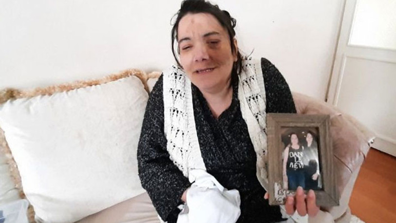 Damak ameliyatında yüz felci geçiren kadından kötü haber