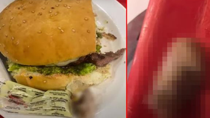 Mide bulandıran olay: Hamburgerden insan parmağı çıktı