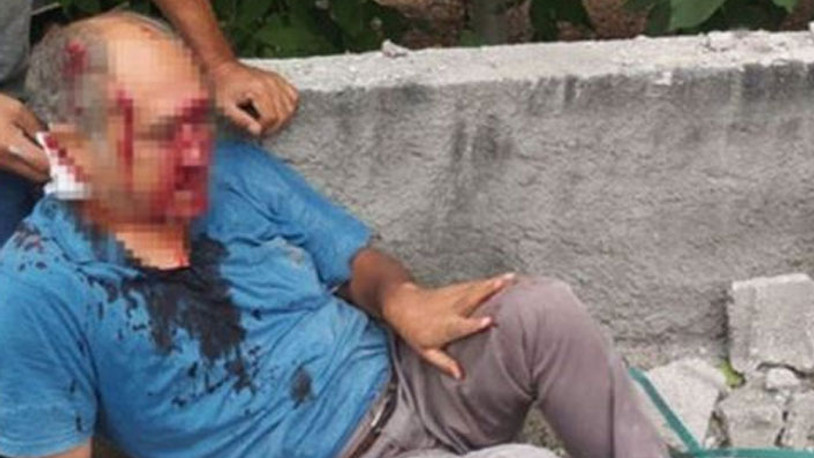 Yolda yürüyen yurttaş bir anda kanlar içinde kaldı