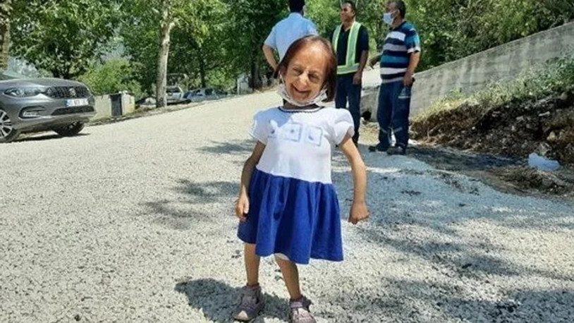 Türkiye'nin en kısa boylu kadını zatürre nedeniyle hayatını kaybetti