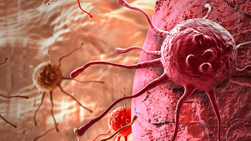 Kanserle savaşta yeni yöntem... Kemoterapi tarih mi oluyor? 