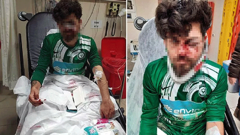 Kırmızı kart gören futbolcu, yerde yatan rakibinin yüzüne tekme attı