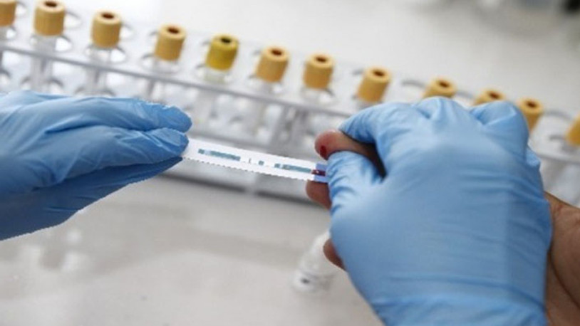 Avrupa'da hızla yayılıyor: Yeni HIV/AIDS mutasyonu