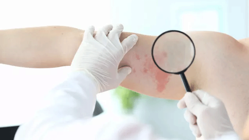 Koronavirüsün bir belirtisi daha ortaya çıktı 