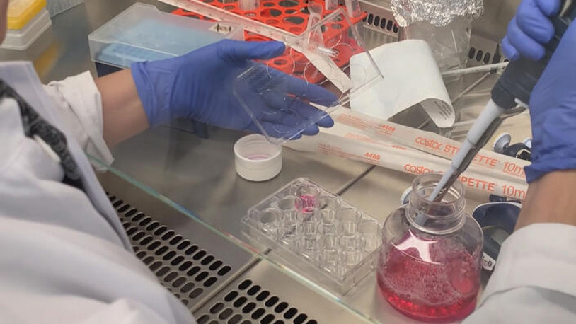 Tıp dünyasında heyecanlandıran gelişme: HIV’i yenen ilk kadın