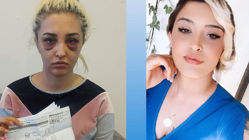 Sevgilisinden ayrılmak isteyen genç kadın dehşet dolu anlar yaşadı