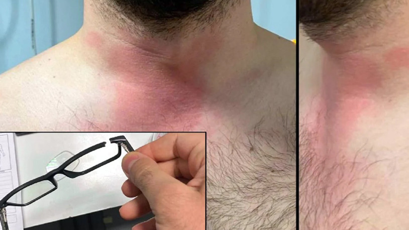 Valilikten doktoru darbeden uzman çavuş hakkında açıklama