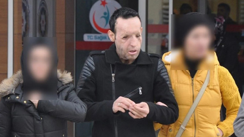 Yüz nakli operasyonu ile tanınan Recep Sert, gözaltına alındı